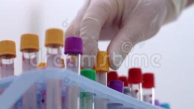 戴着医用手套的实验室工作人员正在为血液取样架dna取试管，进行特写